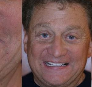 male patient before and after treatment
